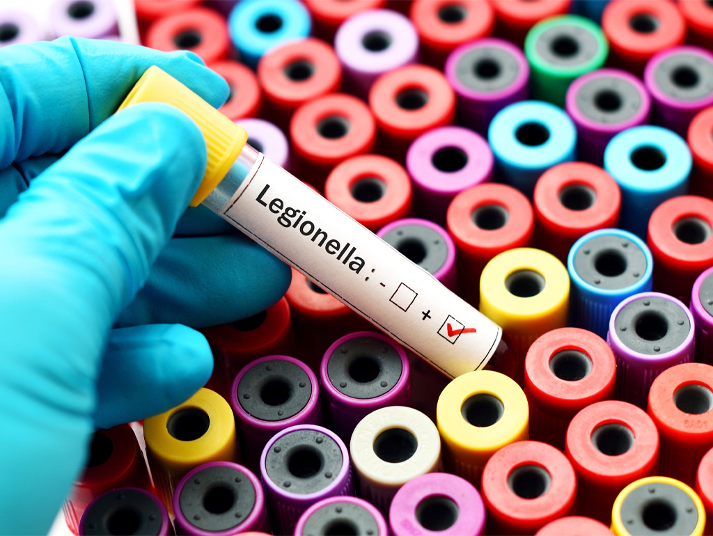 Analisi Legionella Lombardia